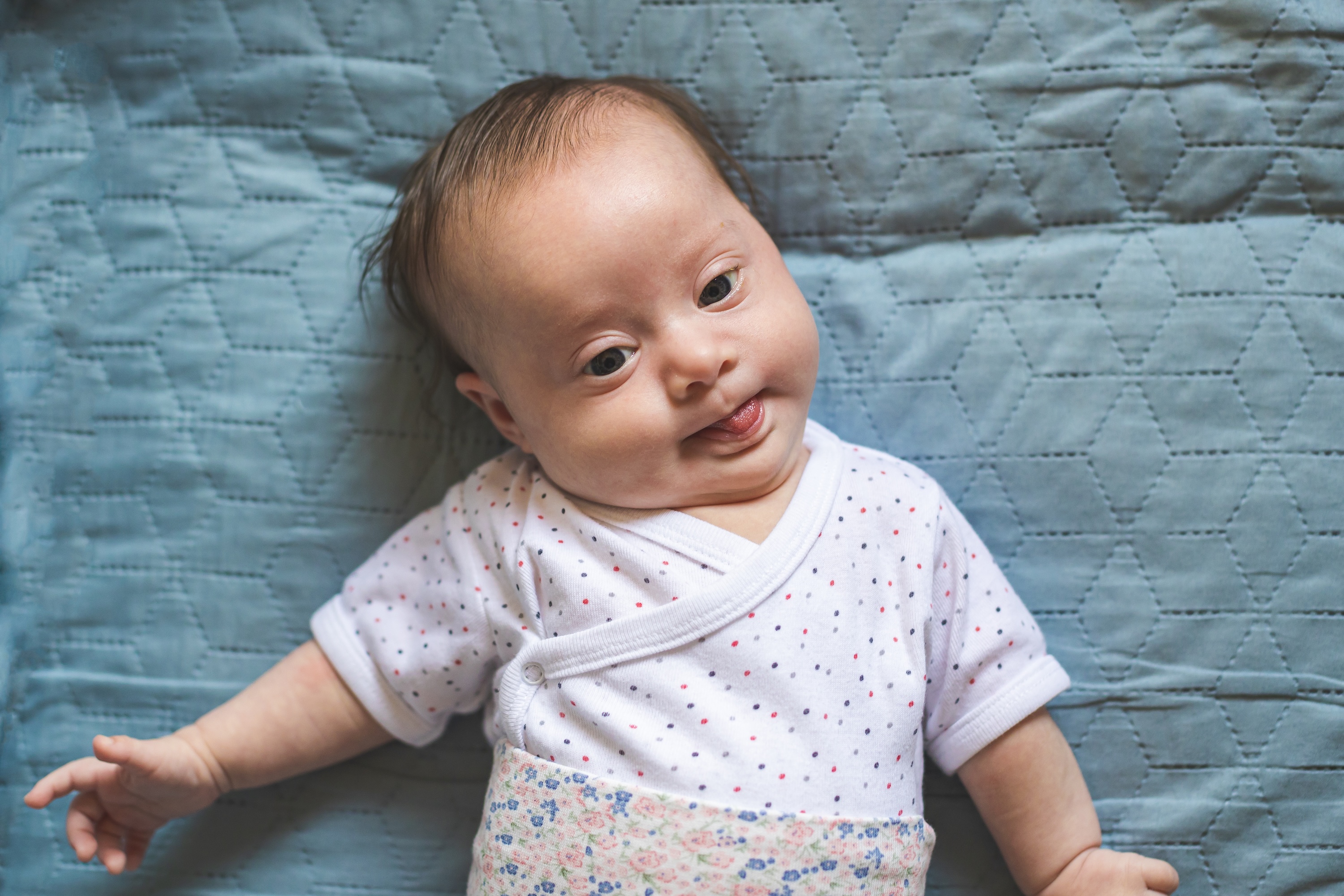 Infant with Down syndrome lying down on blanket